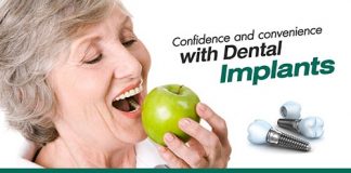 dental implant